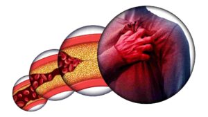 Heart Attack Symptoms: হার্ট অ্যাটাকের আগে এই লক্ষণগুলি দেখা যায়, সময়মতো শনাক্ত করুন, অন্যথায়…