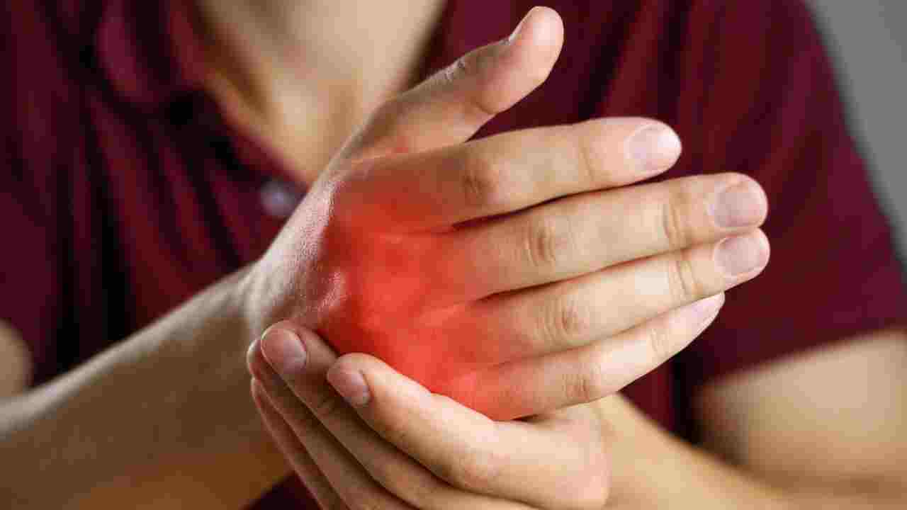 Knuckle Cracking And Arthritis